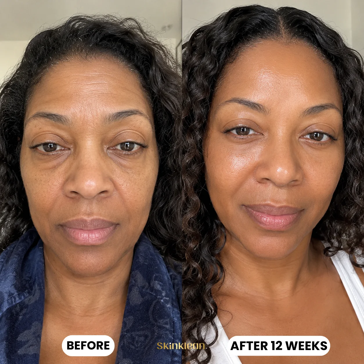 Customer before and after 12 weeks of SkinKlean collagen mask