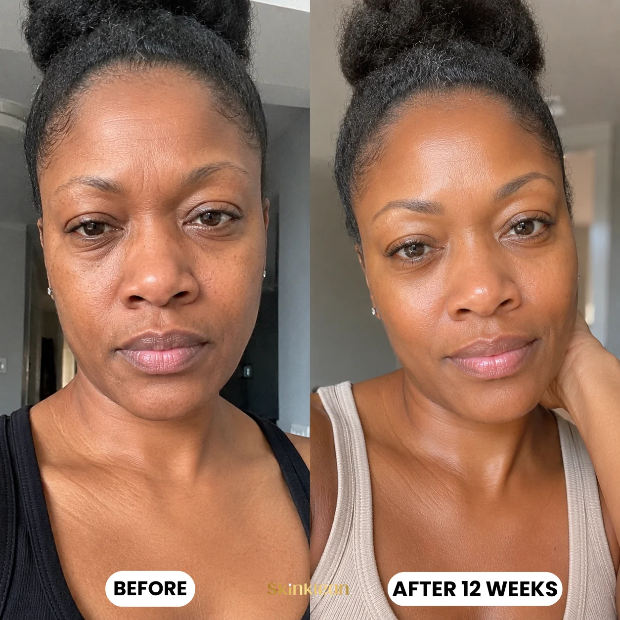 Customer before and after 12 weeks of SkinKlean collagen mask